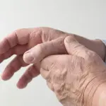 Un mix di farmaci può contrastare l'artrite: il nuovo studio