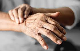 Nuovo test del sangue può temere d'occhio l'avanzare della sclerosi