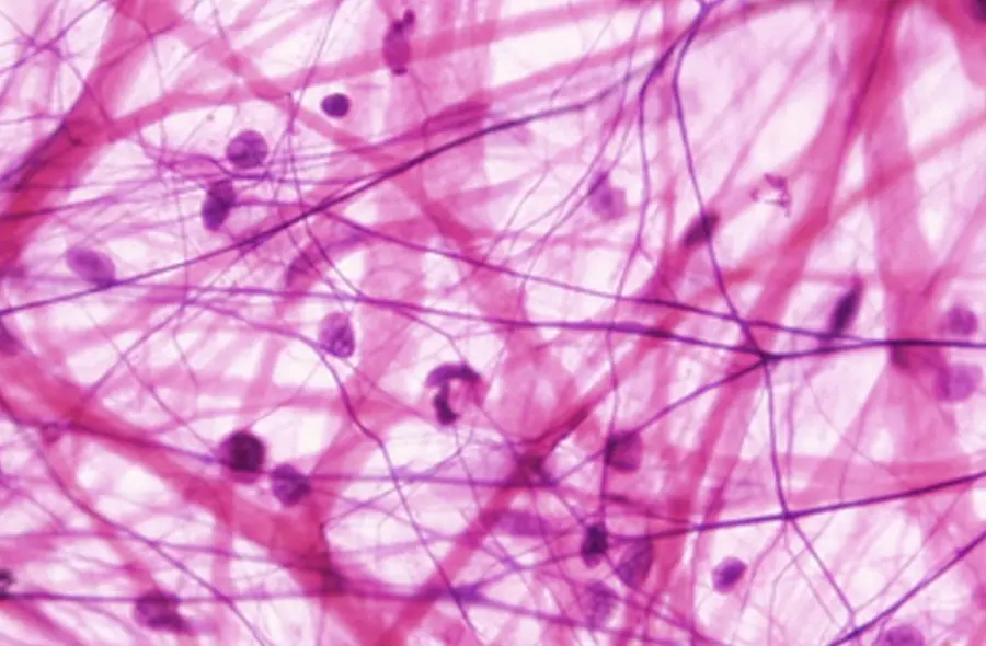 Esame del sangue per individuare precocemente cancro al pancreas: lo studio