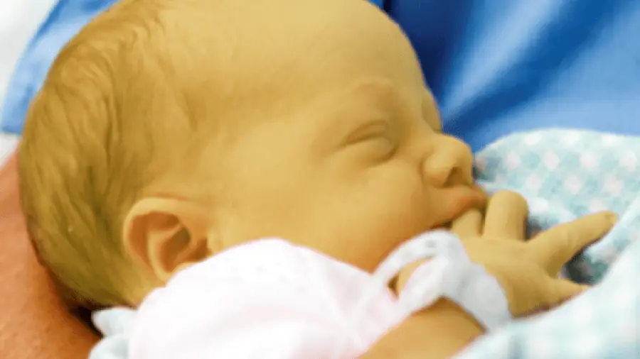 Nasce applicazione per rilevare l'ittero nei bambini