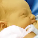 Nasce applicazione per rilevare l'ittero nei bambini