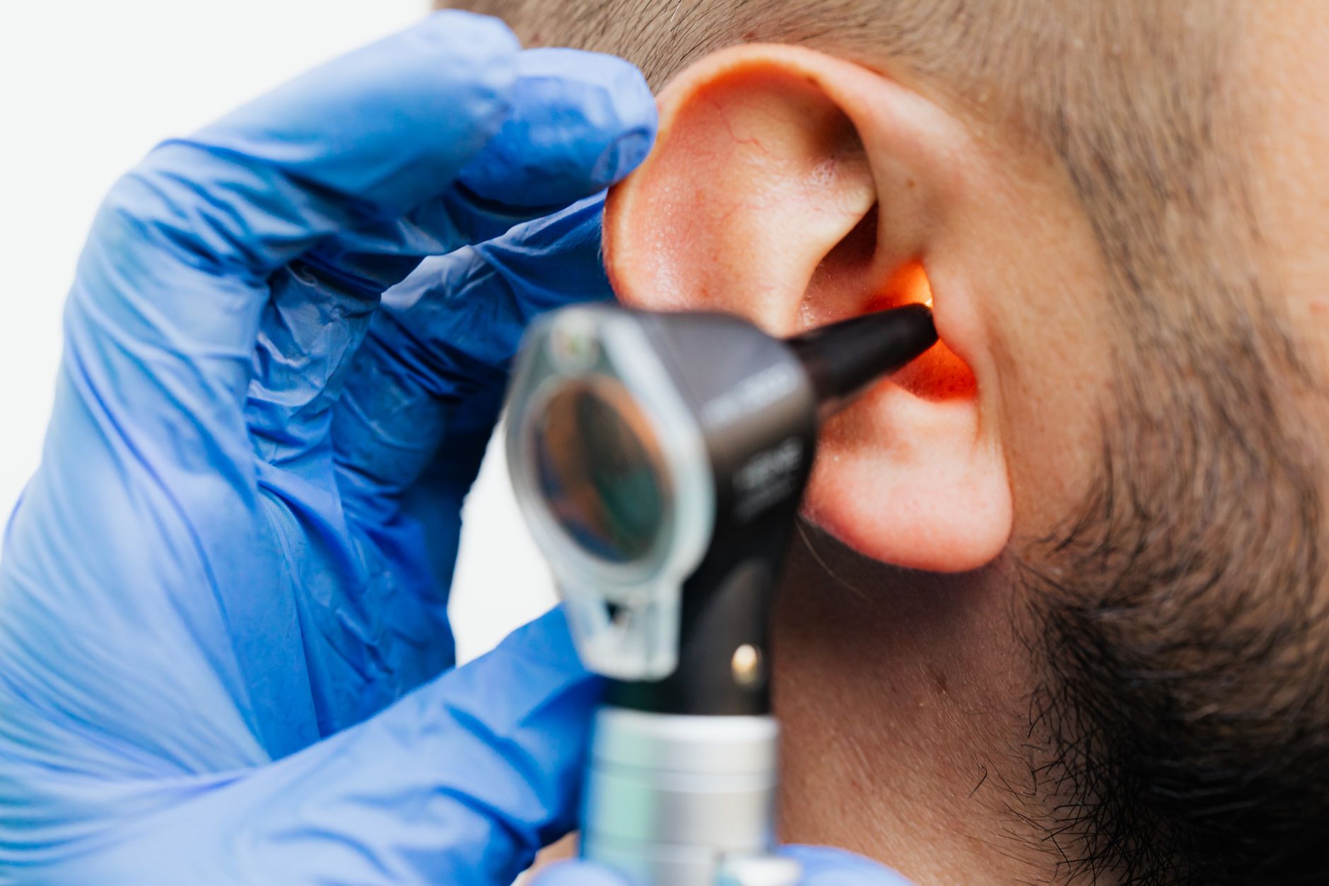 Otiti: sintomi, tipi e quando andare dal medico