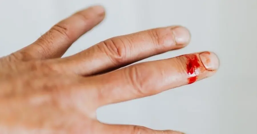 Stimolazione elettrica permette alle ferite di guarire: la scoperta