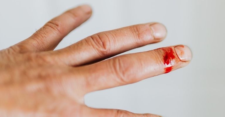 Stimolazione elettrica permette alle ferite di guarire: la scoperta