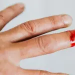 Stimolazione elettrica permette alle ferite di guarire: la scoperta